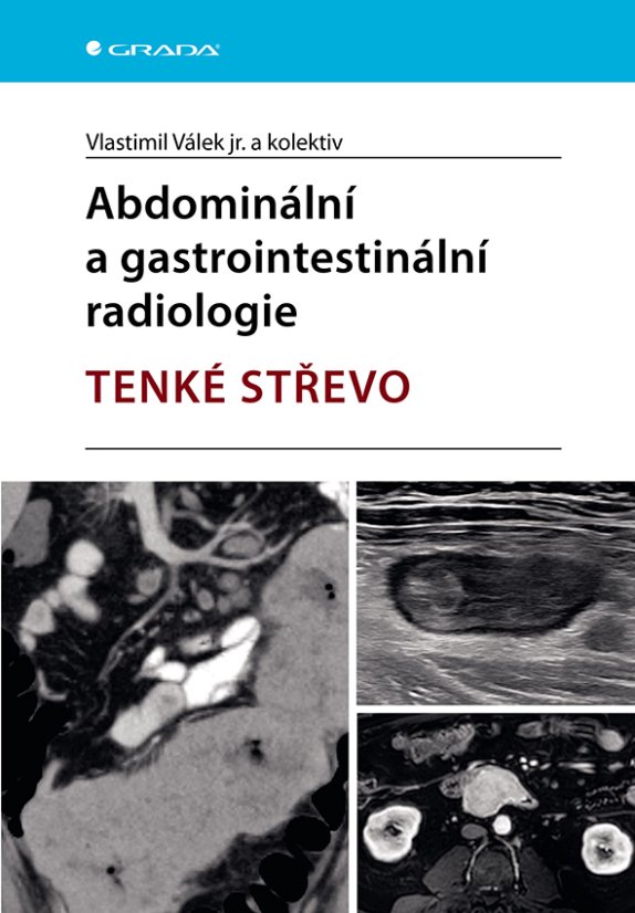 Abdominální a gastrointestinální radiologie - TENKÉ STŘEVO