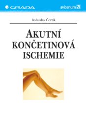 Akutní končetinová ischemie